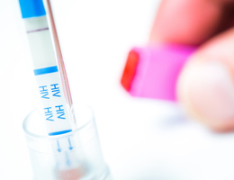  An HIV test strip in a test tube